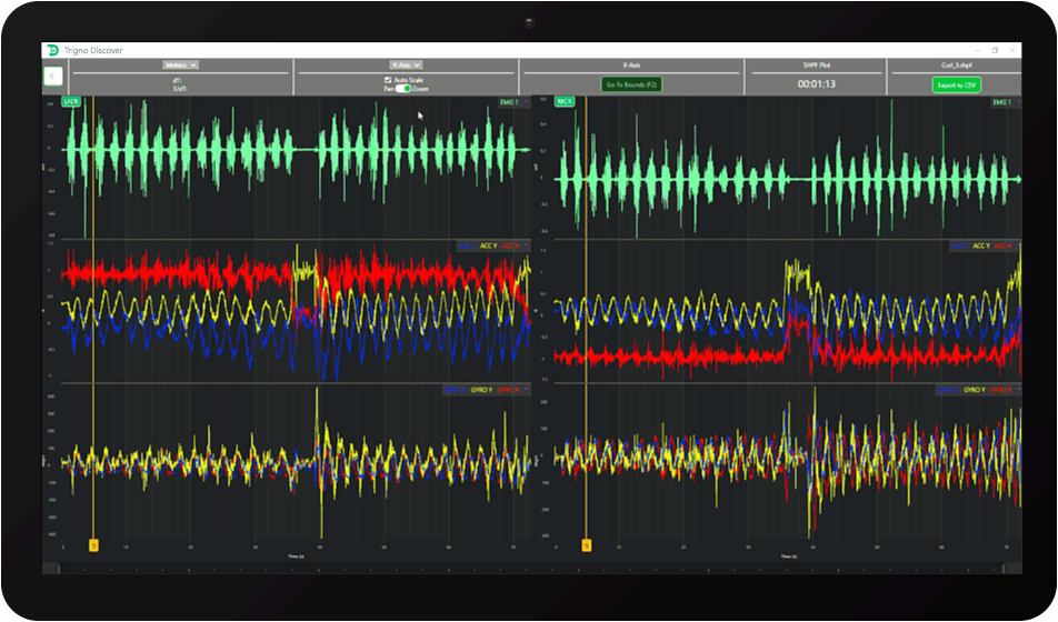 trigno-discover-software-overview-review